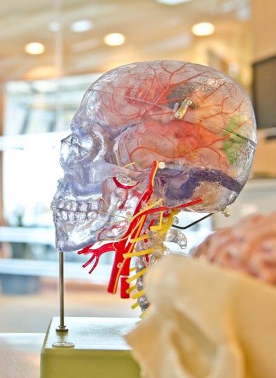 Mit Insighttech kann man das Gehirn medizinisch behandeln, ganz ohne Operation